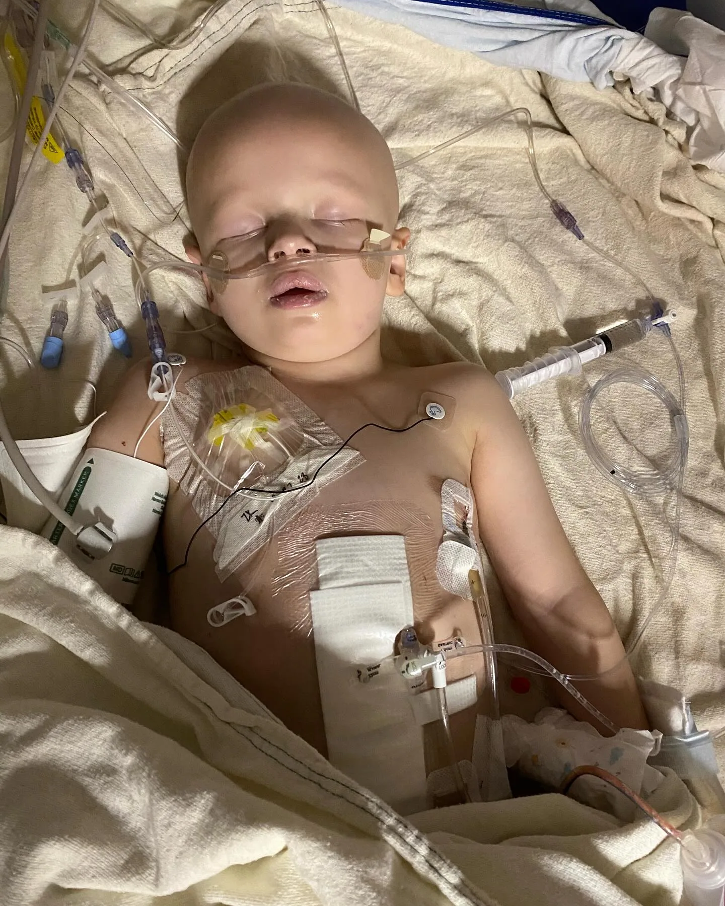 Ajude o pequeno Isaac na luta contra um neuroblastoma em estágio IV - Photo 1